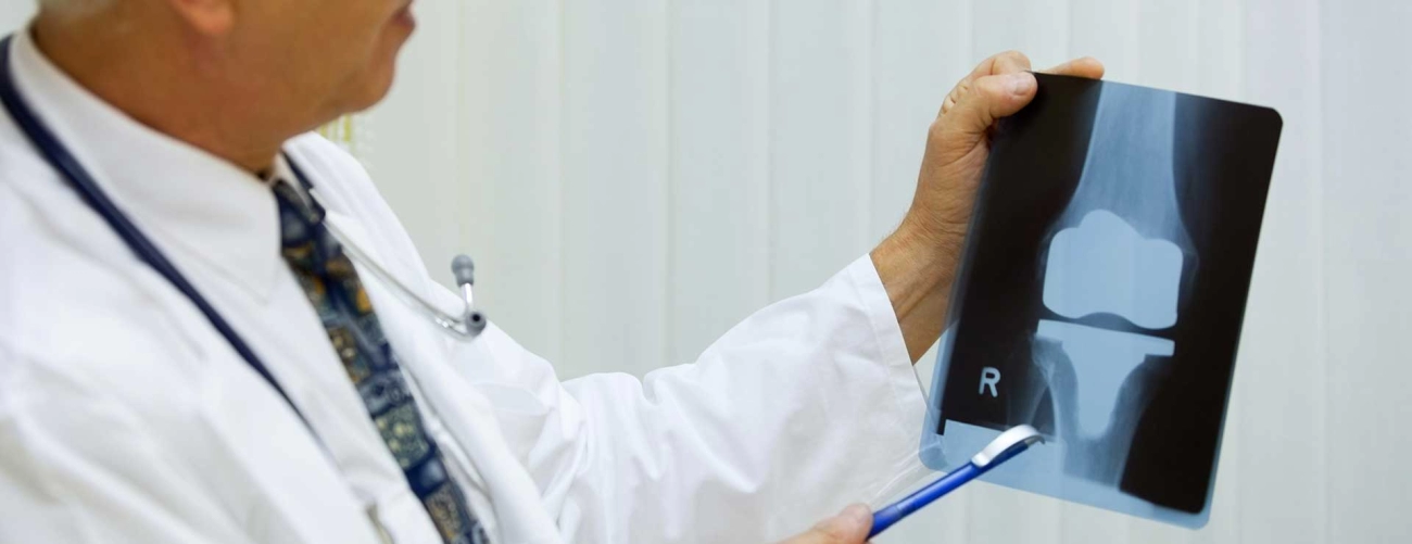 Vast Knee Replacement Support Services