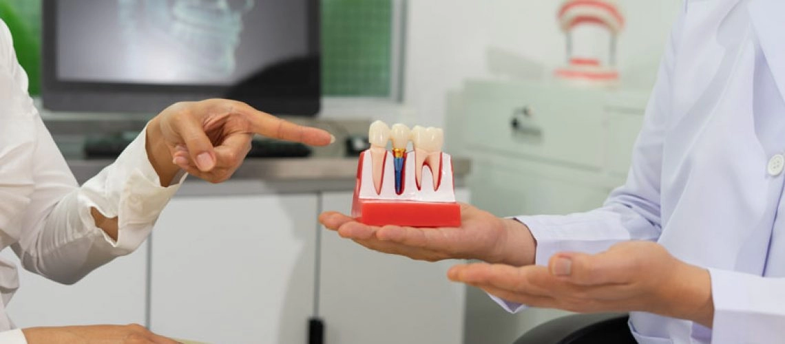 Implant Material Impact on Longevity